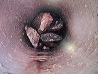 Clogged Sewer Cleaning